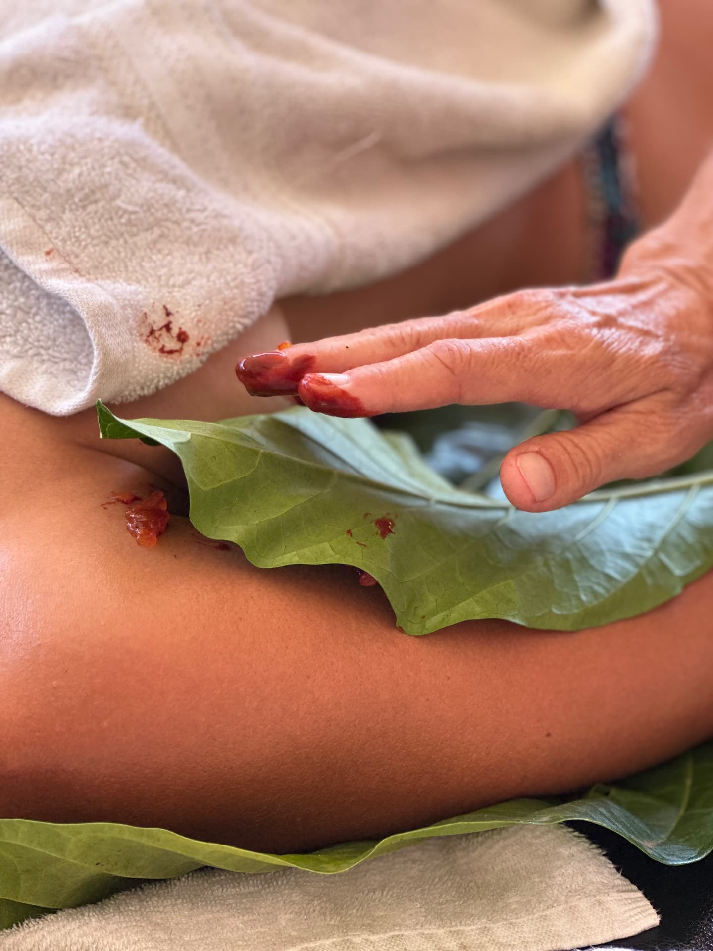 Hands applying a warm noni leaf treatment during a body therapy session